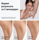 Фотоэпилятор Braun (PL1111 + GIL Venus)