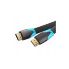Кабель мультимедійний HDMI M to HDMI M 1.5m 4K60Hz black Vention (VAA-B02-L150)